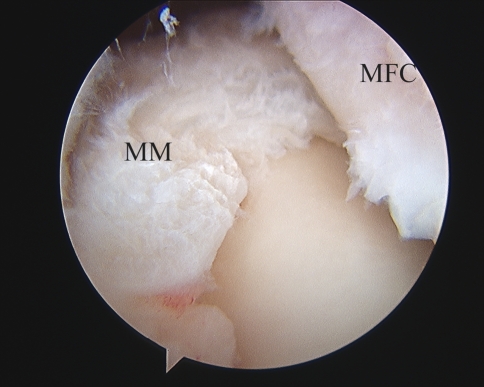 Fig. 1