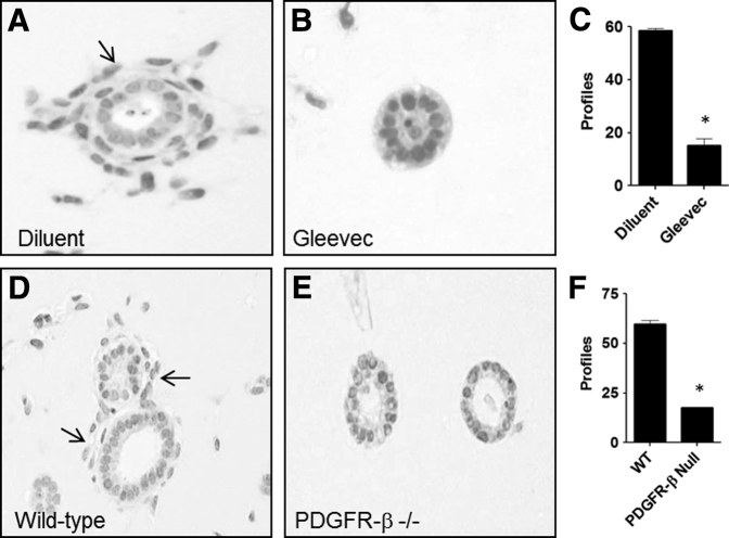 Figure 11