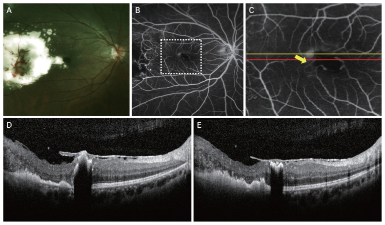 Fig. 4