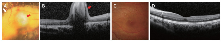 Fig. 2