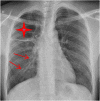 Image 1b