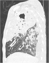 Image 2a