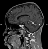 Image 4a