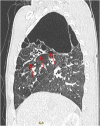 Image 2b