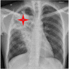 Image 1a