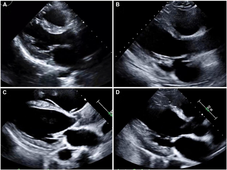 Figure 2