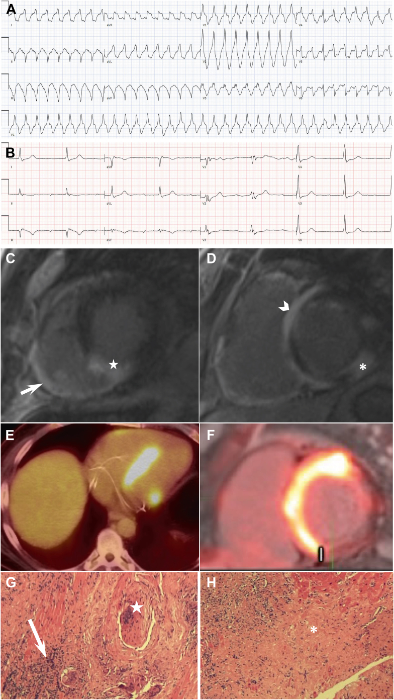 Figure 4