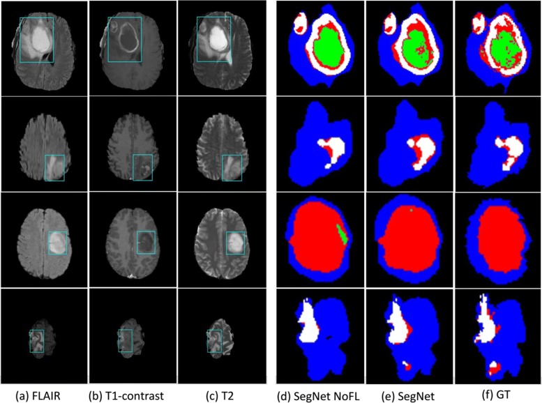 Fig. 4