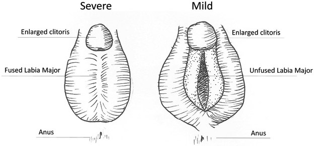 Figure 1 -