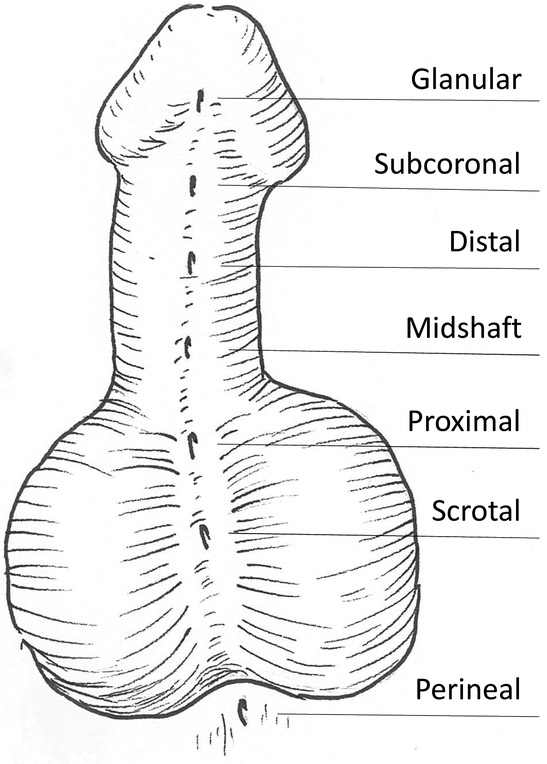 Figure 2 -