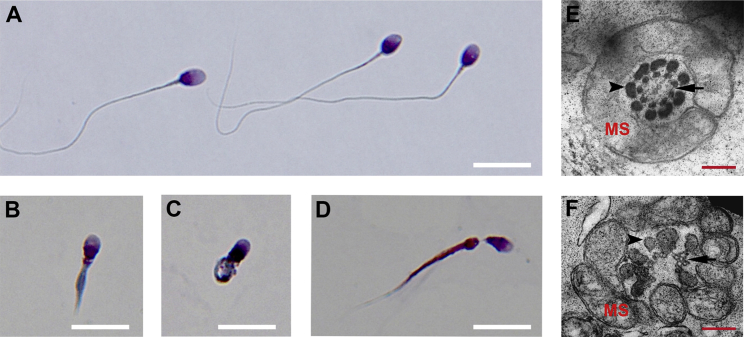 Figure 1