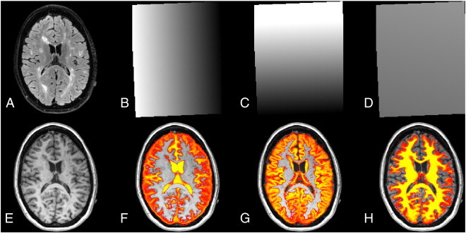 Fig. 1