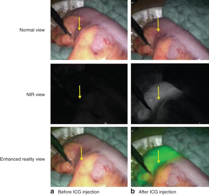 BJS-10844-FIG-0001-c