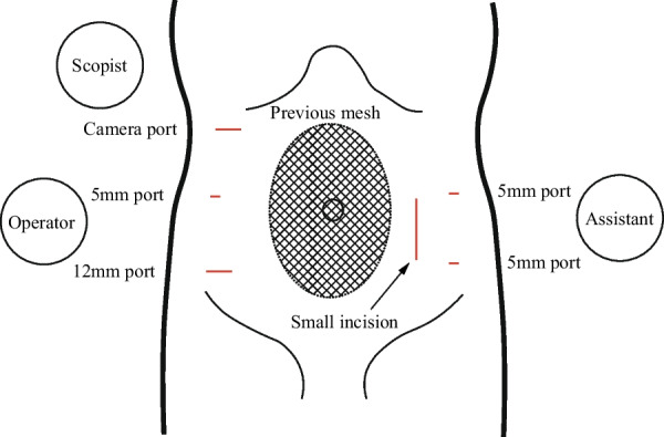 Fig. 4