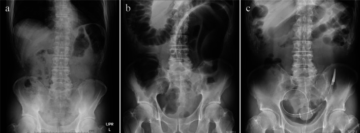 Fig. 1