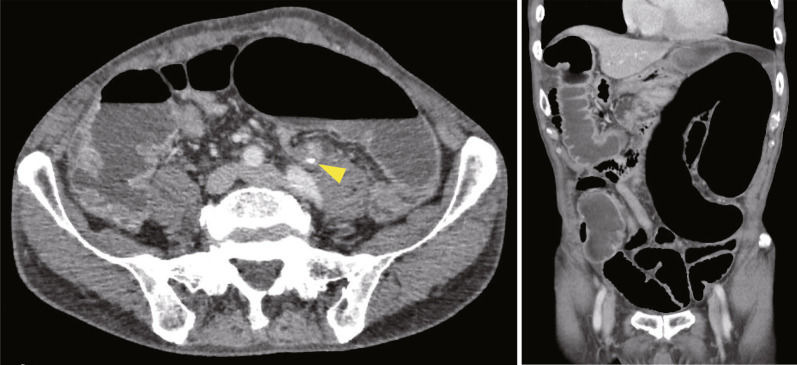 Fig. 2