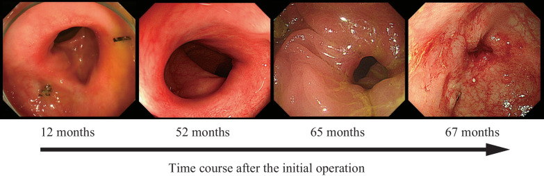 Fig. 3