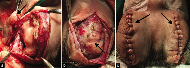 Figure 2: