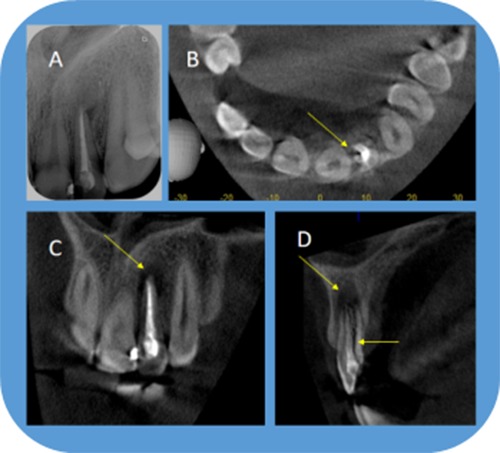 Figure 23.