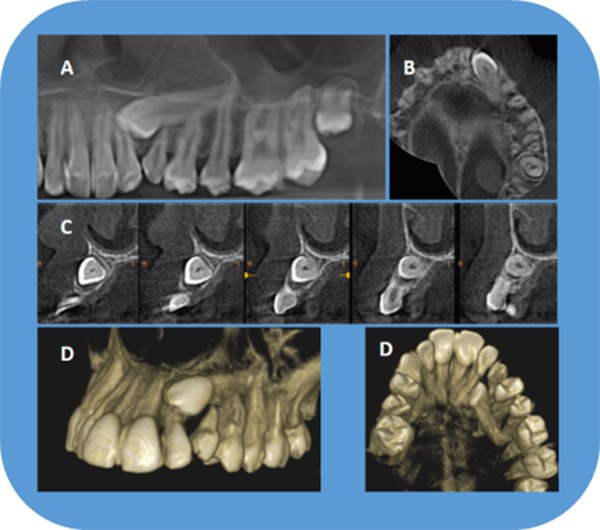 Figure 17.