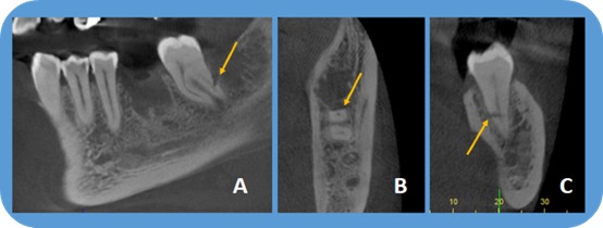 Figure 13.