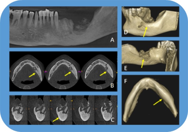 Figure 11.