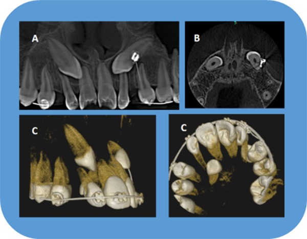 Figure 16.