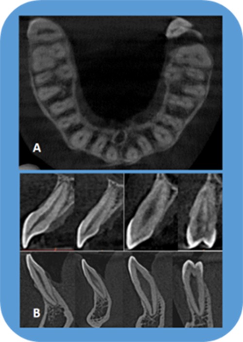 Figure 21.