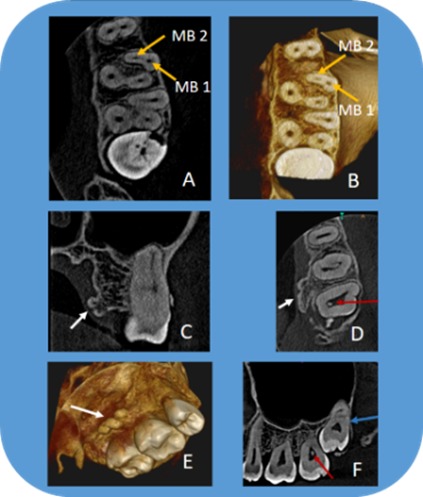 Figure 22.