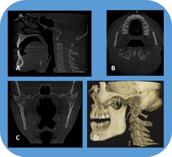 Figure 15.