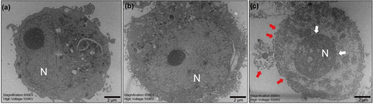 {biw8o30} Exerts Antitumor Effect By Triggering Pyroptosis And 