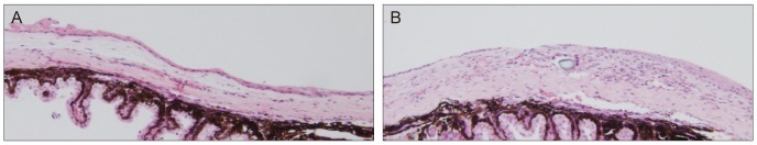 Fig. 1S