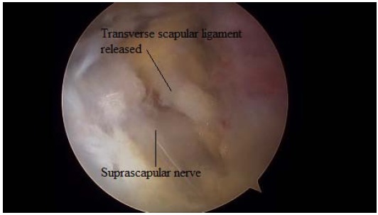 Fig. (11)