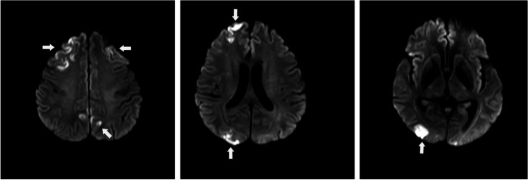 Fig. 1
