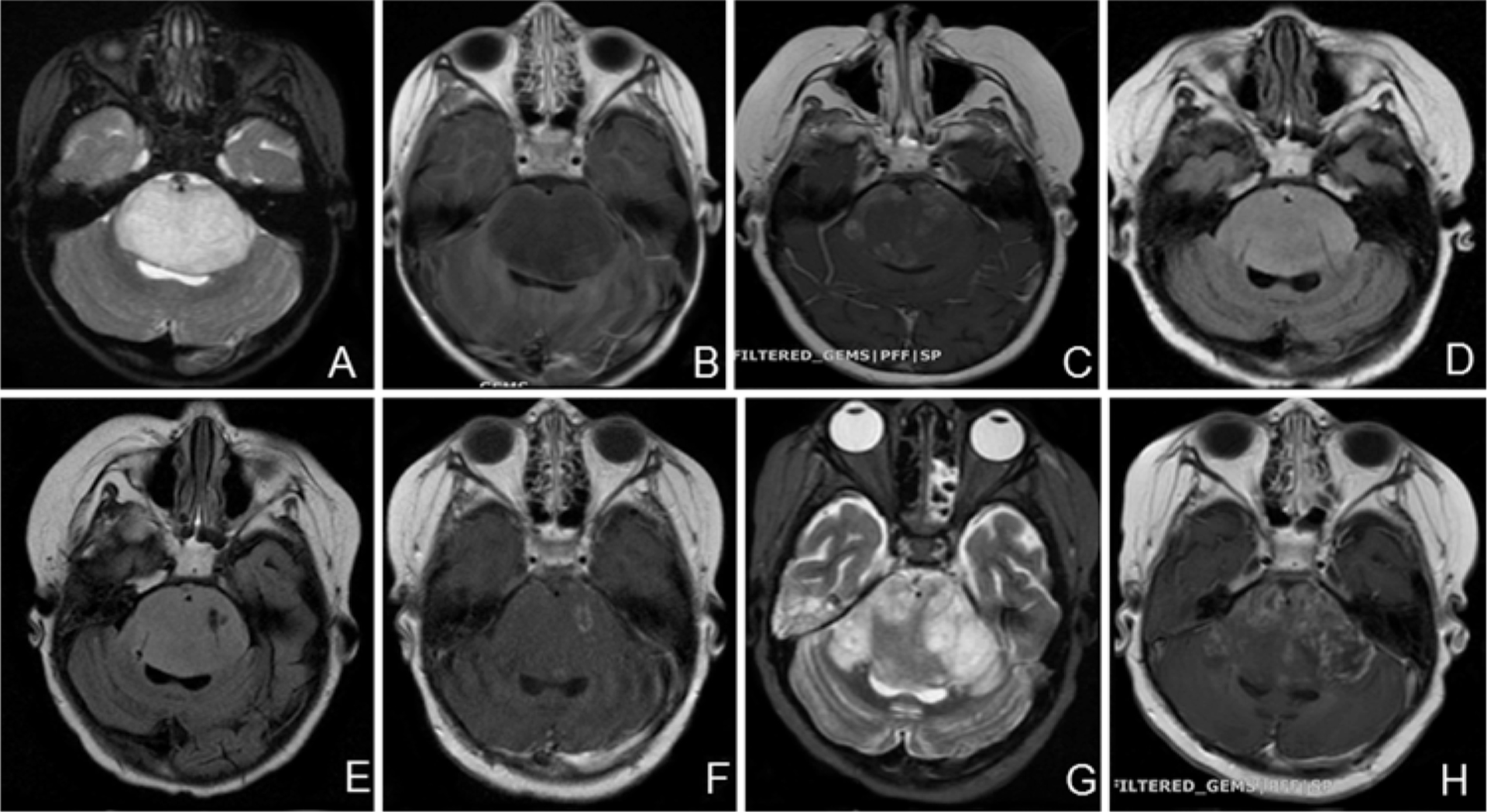 FIG. 2.