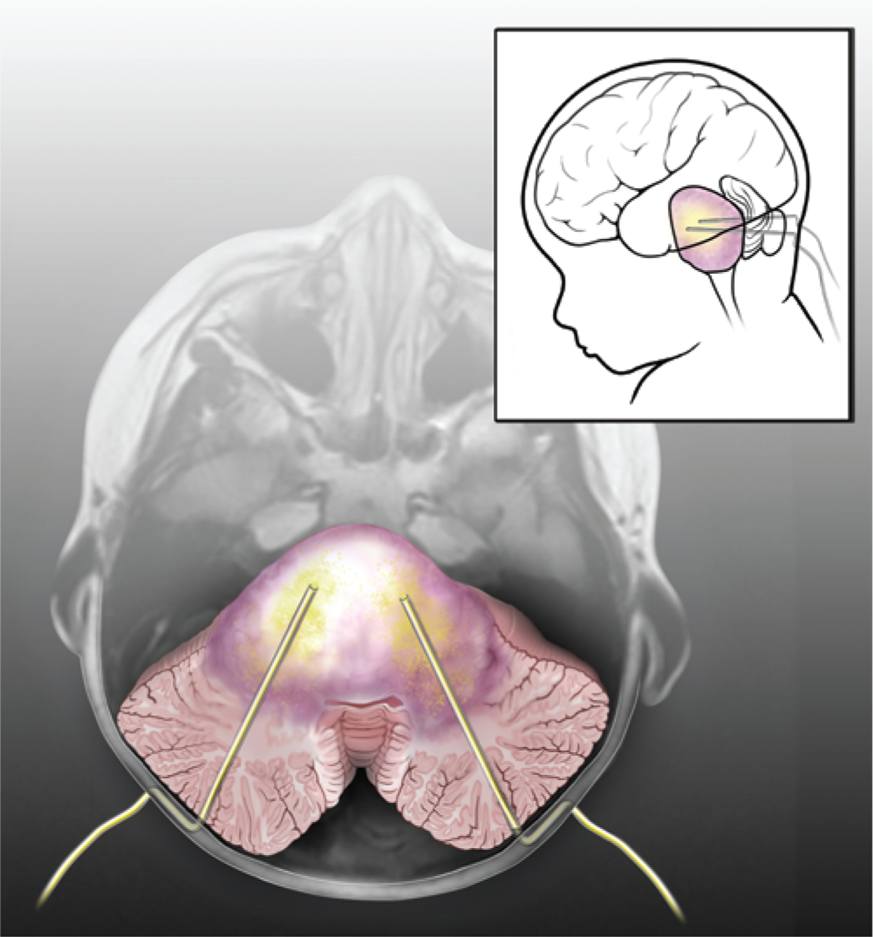 FIG. 1.