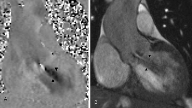 Figure 2A and B