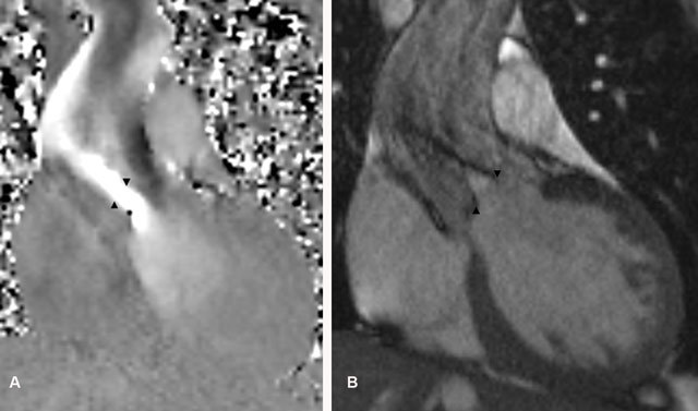 Figure 3A and B