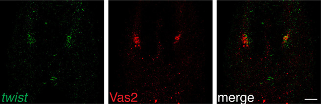 Figure 2—figure supplement 3.