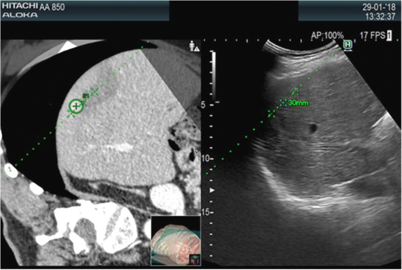 Fig. 1