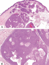 Figure 3 A and B