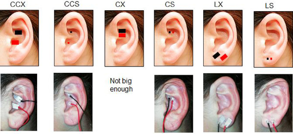 FIGURE 1