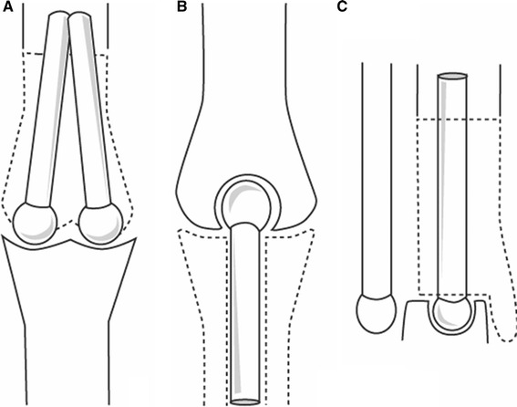 Fig. 9