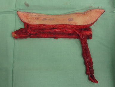 Fig. 5