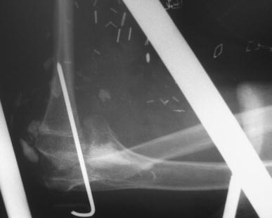 Fig. 6