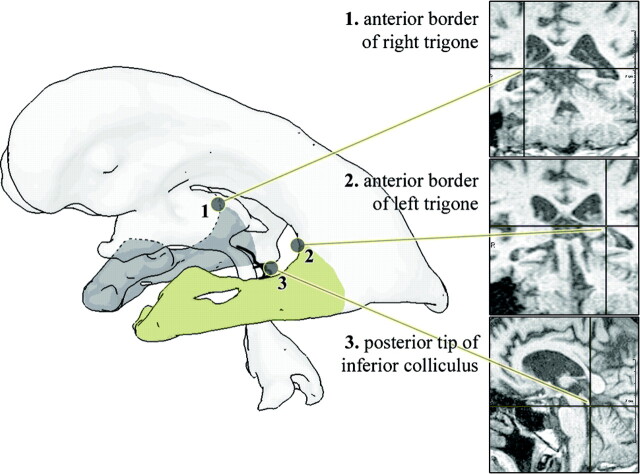 Fig 1.