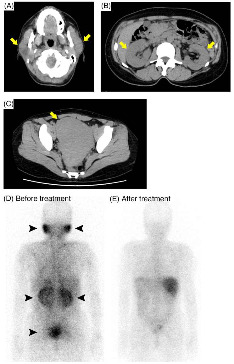 Fig. 1