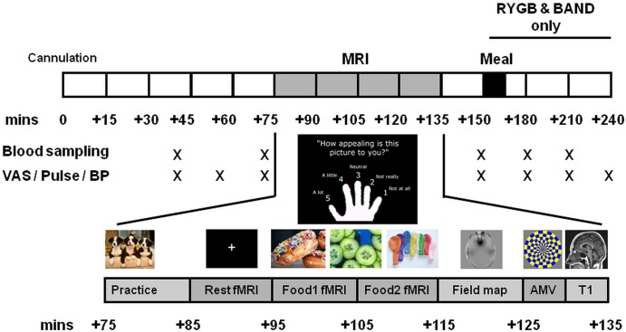 Figure 1