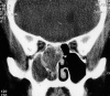 Fig. 1a