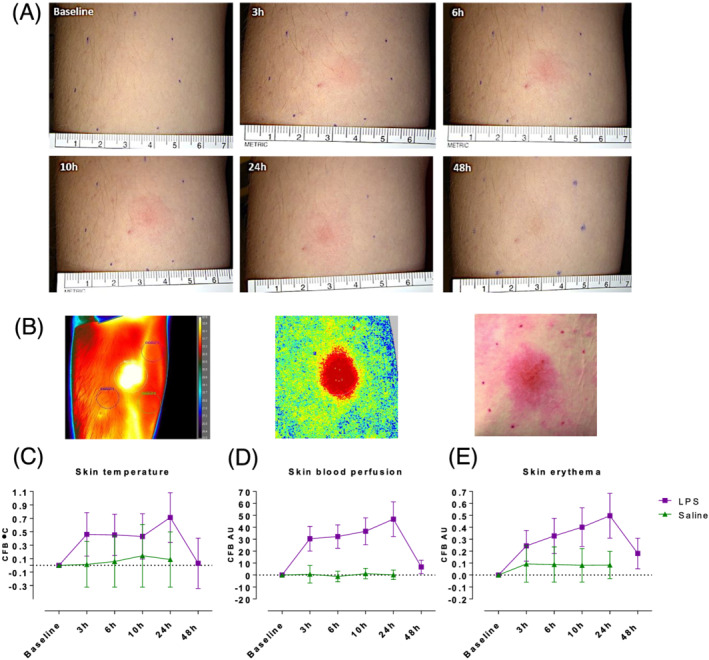 FIGURE 1